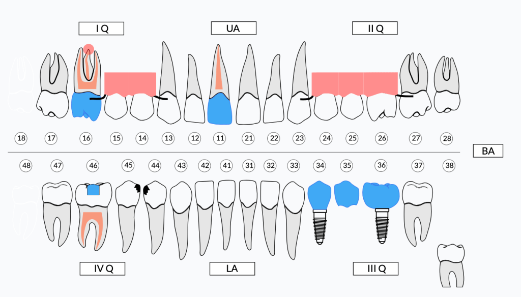 Esame obiettivo nel gestionale per dentisti DentalPlanner